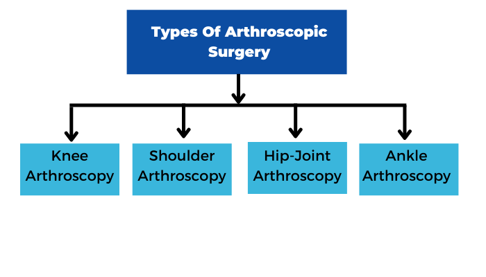 Types Of Arthroscopic Surgery