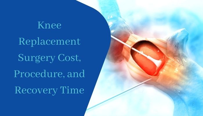 Knee Replacement Surgery Cost, Procedure, and Recovery Time